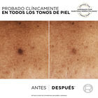 S&eacute;rum Facial Niacinamida Loreal 30 ml Anti-Manchas