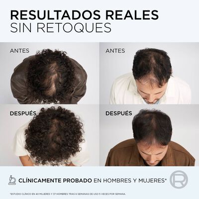 Acondicionador Elvive 150 ml Growth Booster