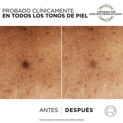 Sérum Facial Niacinamida Loreal 30 ml Anti-Manchas