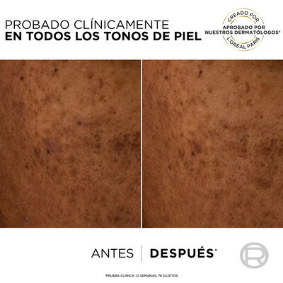 Fluido facial Hidratante Antimanchas Loreal Bright Reveal 50 ml F50+ Niacinamida + Lha