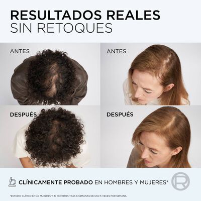 Acondicionador Elvive 150 ml Growth Booster