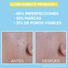 Tratamiento facial Garnier Pure Active Fluido UV Diario con BHA + Niacinamida FPS50+