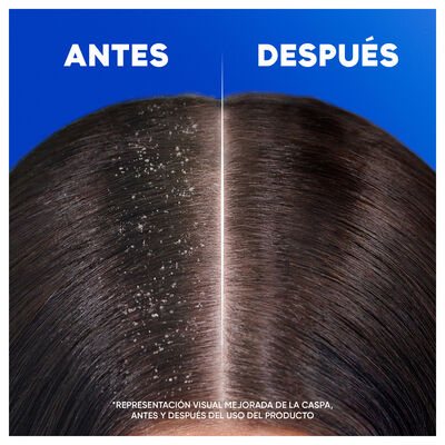 Champ&uacute; H&S 330 ml Antica&iacute;da