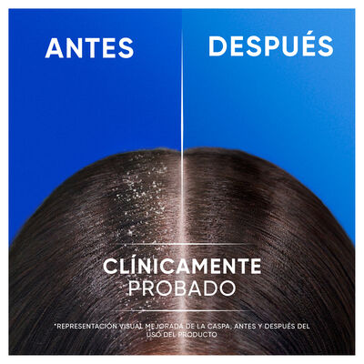 Champ&uacute; 2 en 1 cl&aacute;sico H&S para cabello y cuero cabelludo, 330 ml