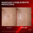 Serum facial Revitalift L'Oreal 30ml triple laser antiedad + anti-manchas