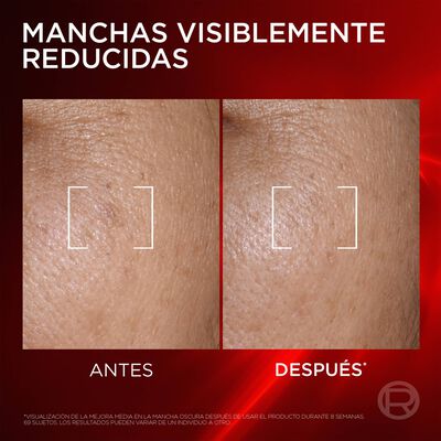 Serum facial Revitalift L'Oreal 30ml triple laser antiedad + anti-manchas