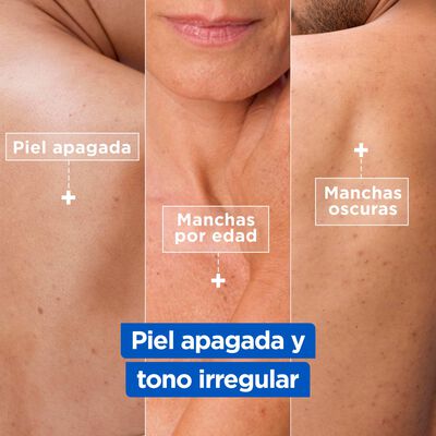 Crema corporal hidratante antimanchas Mixa 400ml